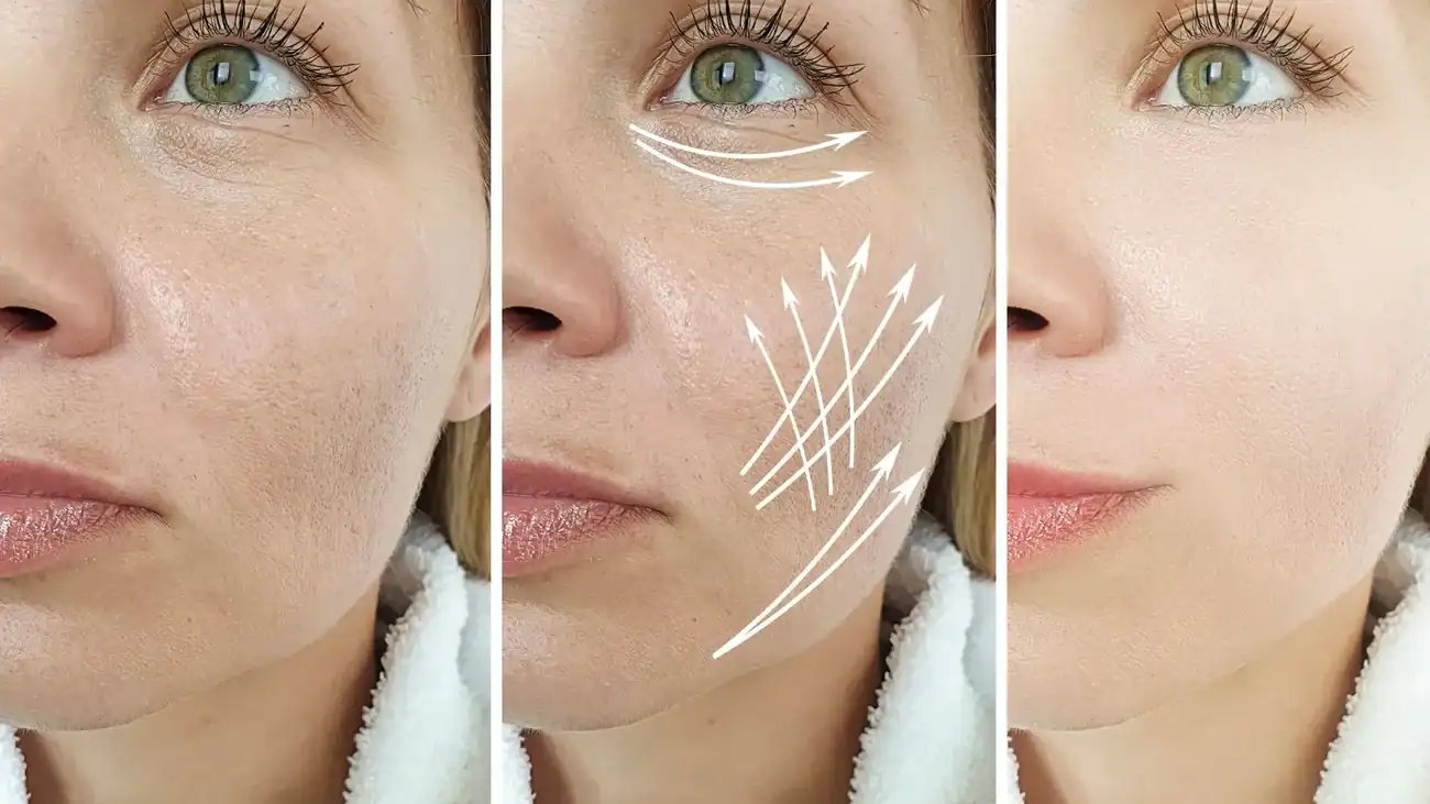 Can One Treatment Really Tackle More Than One Skin Concern Earls Barton?