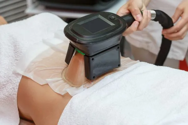 Image of person having fat freezing treatment to help weight gain Earls Barton