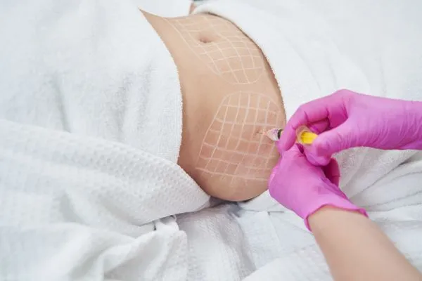 image of fat dissolving injections on love handles to help combat weight gain Earls Barton
