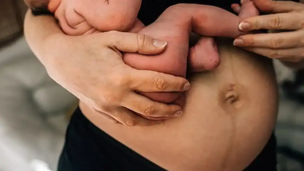 Why Is My Stomach Still Big After Pregnancy Earls Barton?